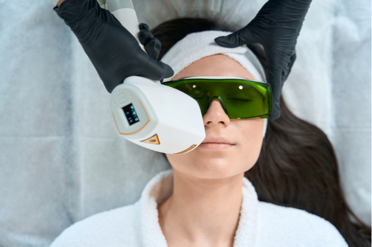 Laser Hair Removal